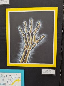 Una obra de arte llena de color que representa una radiografía de una mano, enmarcada en amarillo y expuesta sobre un fondo negro.