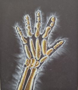 Illustration of a human hand skeleton in white and yellow chalk on a black background, highlighting bone structure.